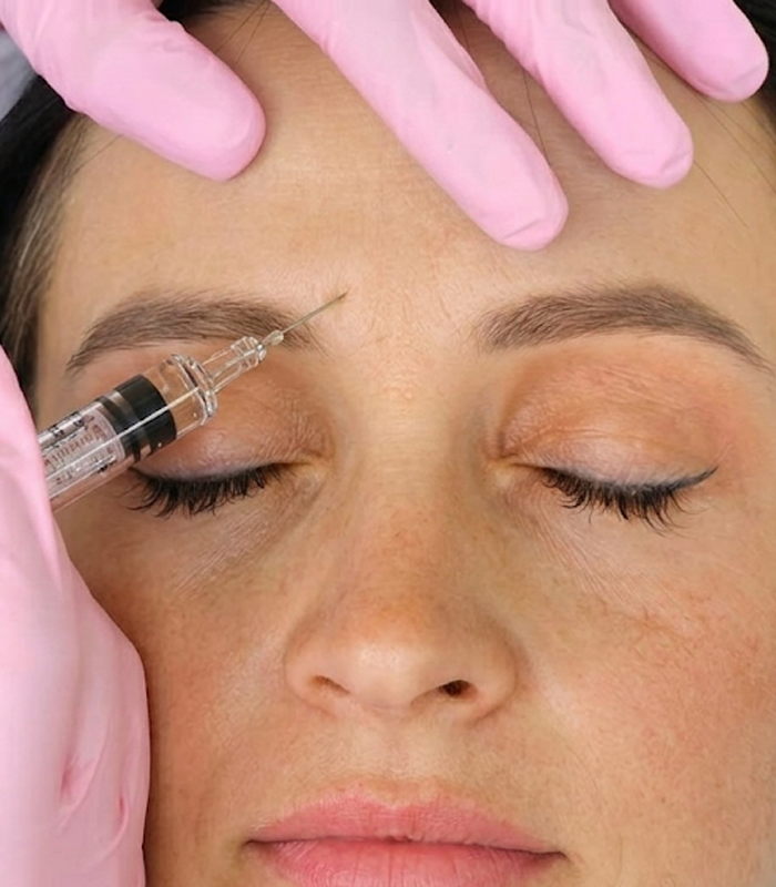 Skin PRP treatment using natural growth factors to rejuvenate skin and improve texture and tone